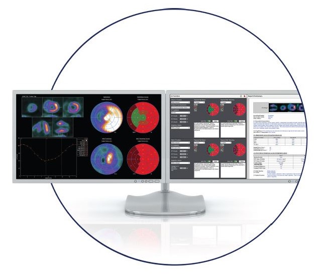 INVIA 4DM standalone software for PET/CT camera plus MFR quantification