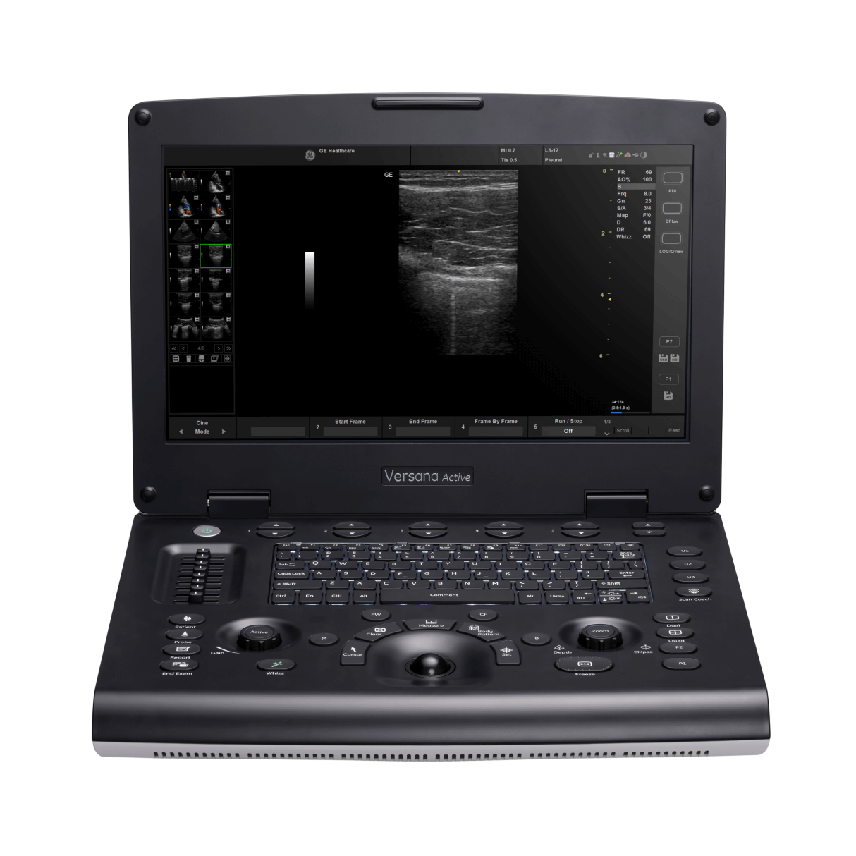 Versana Active Ultrasound  GE HealthCare (United States)